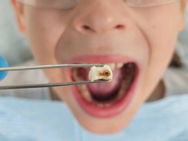 Best Holiday Emergency Dentist in Atherton, CA