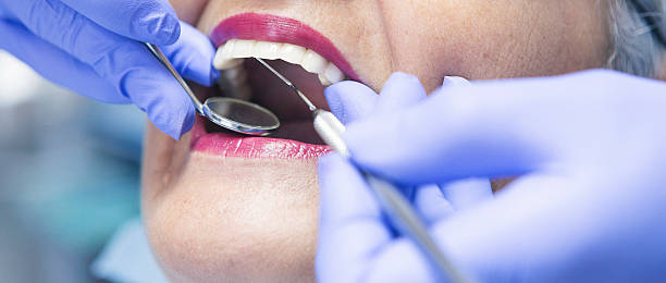 Best Emergency Dental Extractions in Atherton, CA